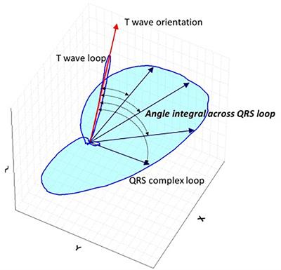 QRS-T Angle Predicts Cardiac Risk and Correlates With Global Longitudinal Strain in Prevalent Hemodialysis Patients